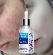 BIOAQUA Acne Removal & Acne Serum Solution.