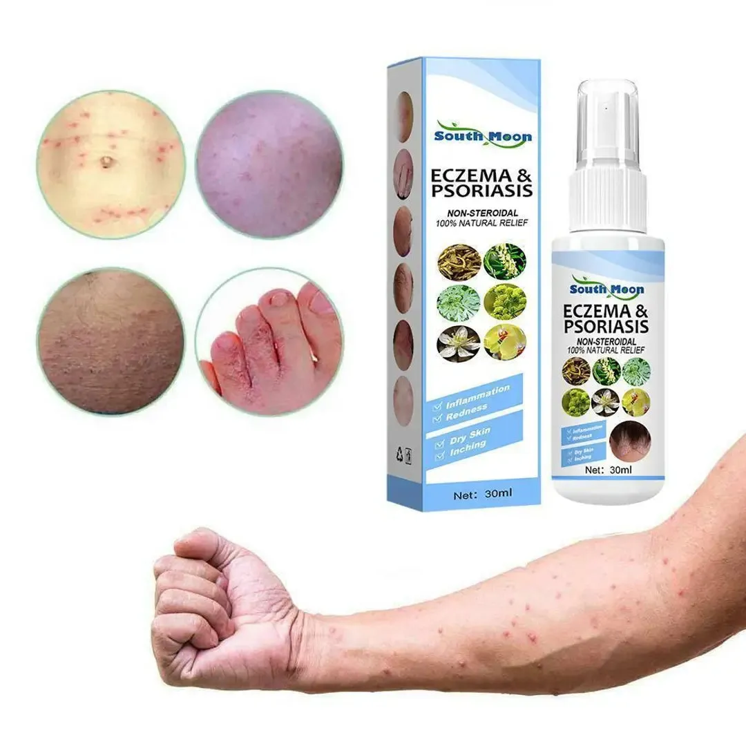 Herbal Psoriasis Relief Spray