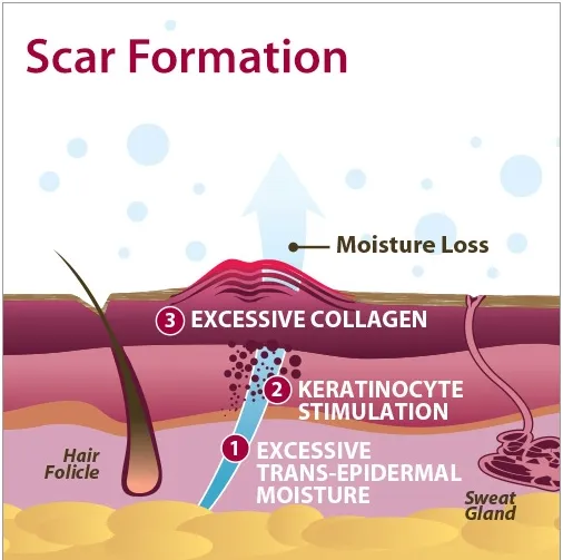 Xeragel Silicone Ointment