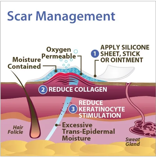 Xeragel Silicone Ointment